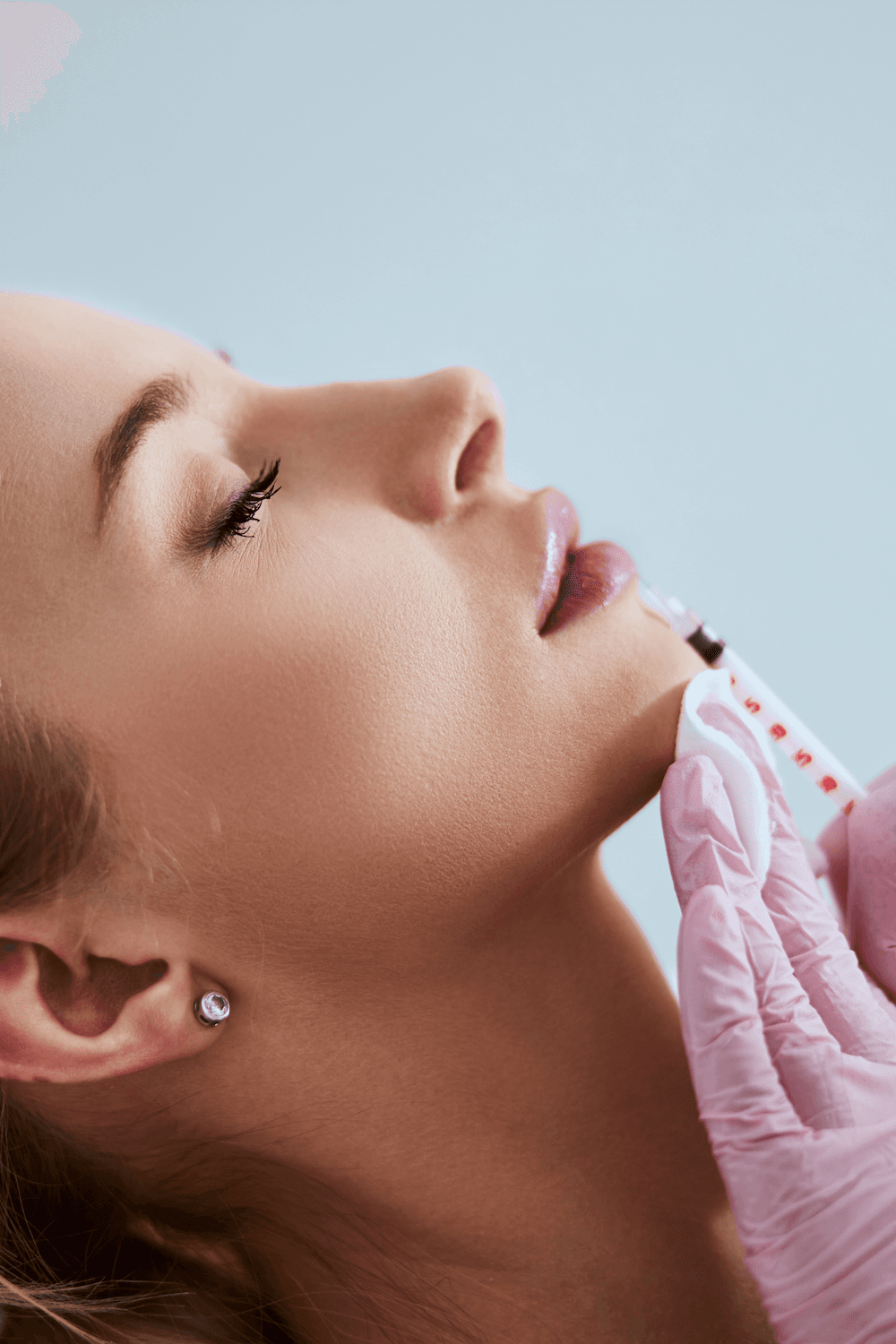 Dermal Fillers