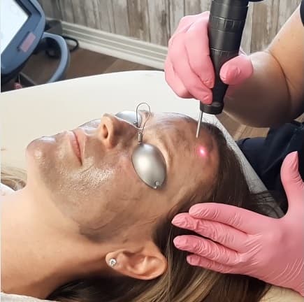 Hollywood Facial